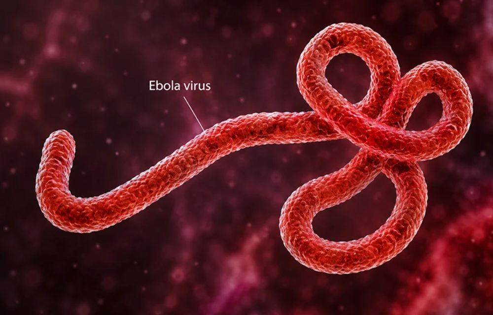 ebola virus